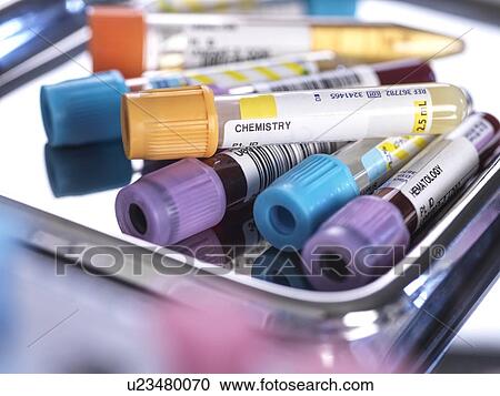 Samples for medical screening View Large Photo Image Stock Image - Samples for medical screening. Fotosearch