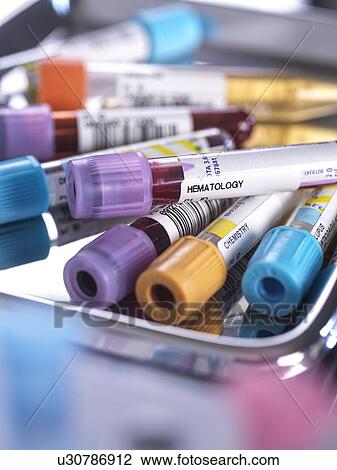 Stock Image - Samples for medical screening. Fotosearch