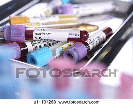 Samples for medical screening View Large Photo Image Stock Photo - Samples for medical screening. Fotosearch