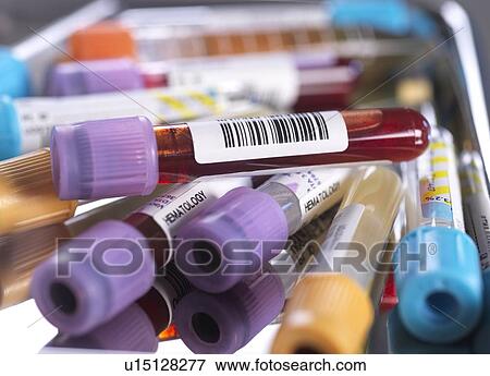 Stock Photo - Samples for medical screening. Fotosearch