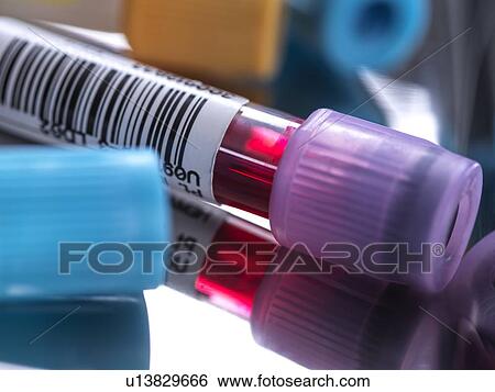 Samples for medical screening View Large Photo Image Stock Photograph - Samples for medical screening. Fotosearch