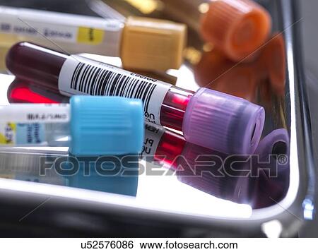 Stock Photograph - Samples for medical screening. Fotosearch