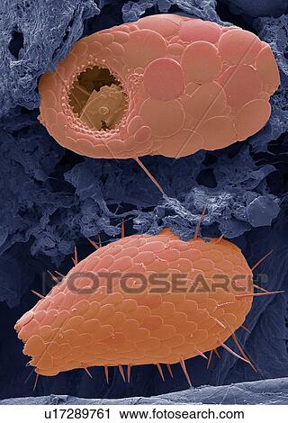 Stock Image - Shelled amoebae, SEM. Fotosearch