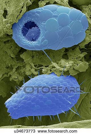 Stock Image - Shelled amoebae, SEM. Fotosearch