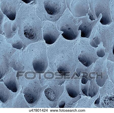 Picture - Tooth dentine, SEM. Fotosearch