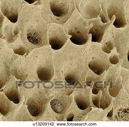 Stock Image - Tooth dentine, SEM. Fotosearch