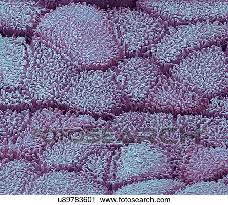 Stock Image - Urethra, SEM. Fotosearch