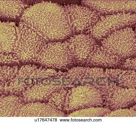 Stock Photo - Urethra, SEM. Fotosearch