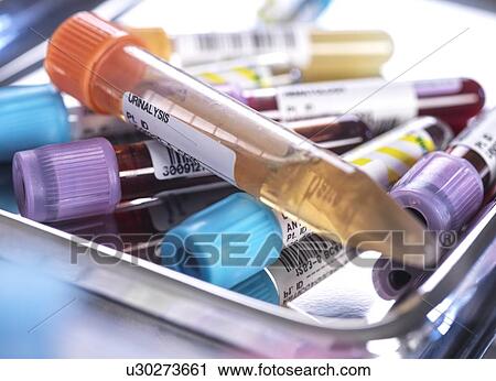 Stock Image - Urine test sample. Fotosearch