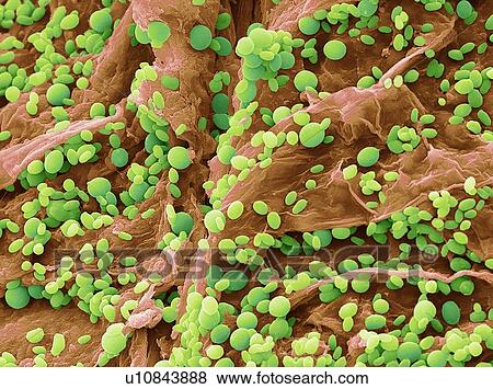 Stock Photo - Yeast, SEM. Fotosearch