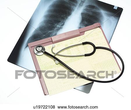 Stock Photo - X-ray, chart and stethoscope. Fotosearch
