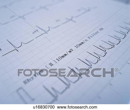 Stock Image - Graph . Fotosearch