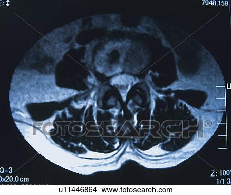 X-ray of a human stomach View Large Photo Image Picture - X-ray of a human stomach. Fotosearch