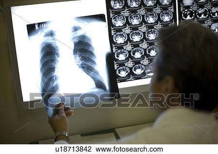 Stock Image - Doctor examining x-ray image. Fotosearch