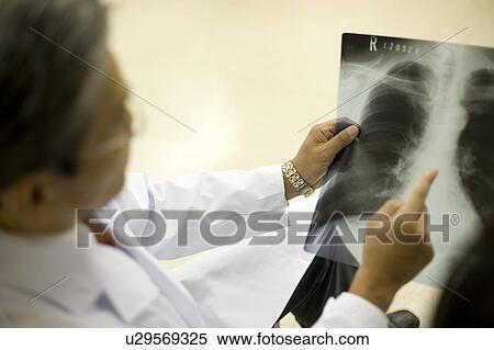 Stock Photography - Doctor looking at x-ray image. Fotosearch