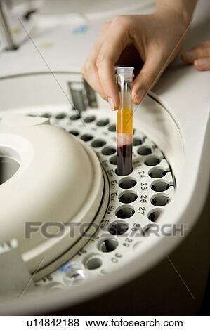 Stock Photo - Nurse holding test tube. Fotosearch