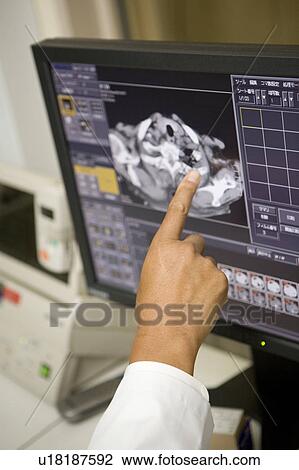 Technician looking at CAT Scan monitor View Large Photo Image Stock Image - Technician looking at CAT Scan monitor. Fotosearch
