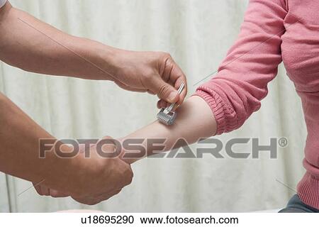 Doctor applying roller needle on patient's arm View Large Photo Image Stock Image - Doctor applying roller needle on patient's arm. Fotosearch