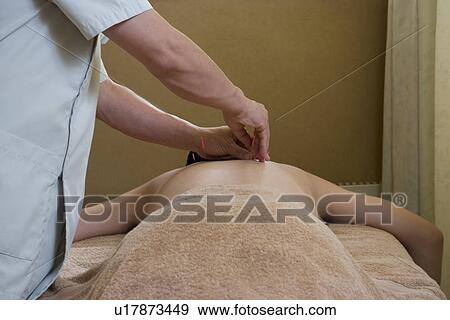 Stock Photo - Doctor putting acupuncture needles. Fotosearch