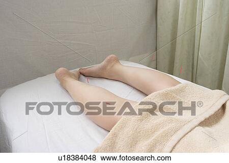 Stock Photo - Legs of a woman receiving acupuncture treatment. Fotosearch