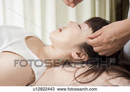 Woman receiving acupuncture treatment View Large Photo Image Stock Image - Woman receiving acupuncture treatment. Fotosearch