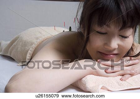 Stock Photo - Young woman receiving acupuncture treatment. Fotosearch