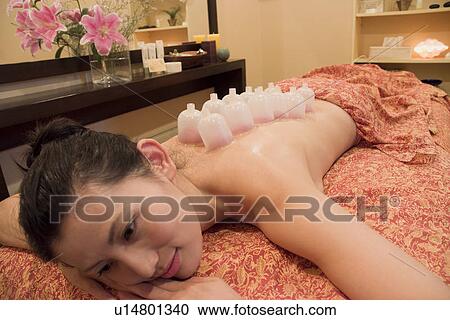 Stock Image - Young woman receiving cupping massage. Fotosearch