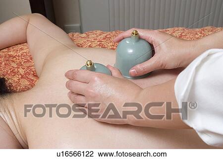 Stock Image - Young woman receiving cupping massage. Fotosearch