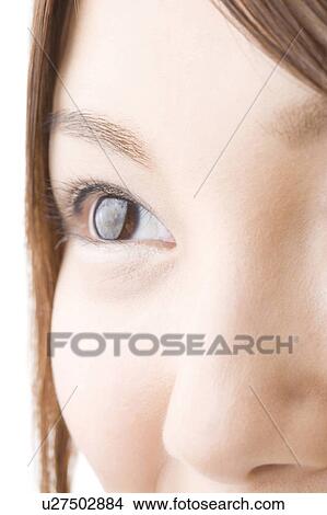 Picture - Jananese black eye. Fotosearch