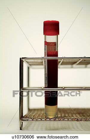 Stock Photograph - Genetic Research, Science, Repetition, Technology, Chemistry, Bio Technology, Metal. Fotosearch