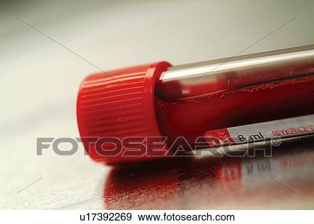 Stock Photo - Scrutiny, Glass, Indoor, Science, Solution, Care, One Object. Fotosearch