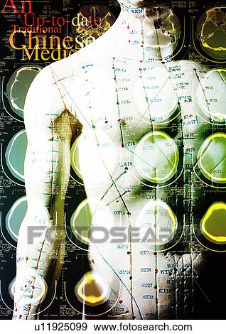 Close-up of medical scans superimposed on a human body View Large Photo Image Stock Photo - Close-up of medical scans superimposed on a human body. Fotosearch