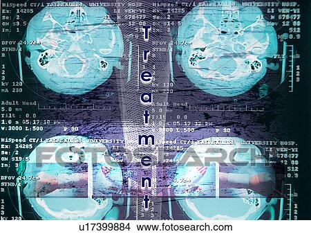 Close-up of text superimposed on scan images View Large Photo Image Picture - Close-up of text superimposed on scan images. Fotosearch