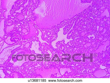 Cell, Cluster, Extreme Close-Up, Full Frame View Large Photo Image Stock Photography - Cell, Cluster, Extreme Close-Up, Full Frame. Fotosearch