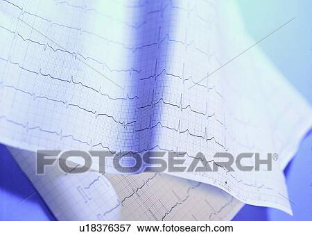 Stock Photo - Close-Up, Ecg, Folded, Graph, Grid. Fotosearch