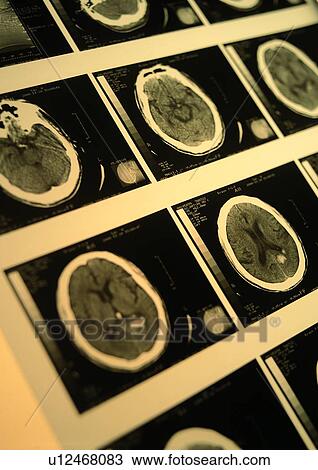 Close-Up, Full Frame, Human Anatomy, Indoor, Medical Procedure View Large Photo Image Stock Image - Close-Up, Full Frame, Human Anatomy, Indoor, Medical Procedure. Fotosearch