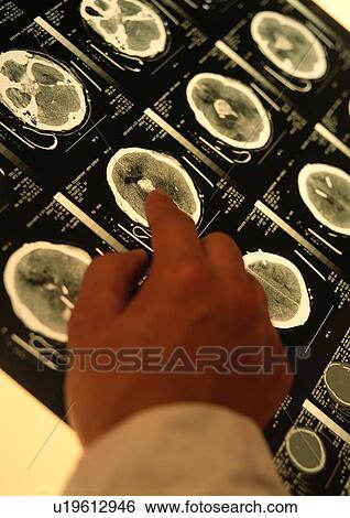 Stock Photograph - Close-Up, Full Frame, Human Anatomy, Human Finger, Human Hand. Fotosearch