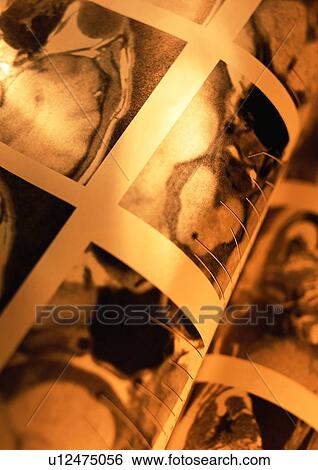 Science And Technology, Mri Scan, Medical Record View Large Photo Image Stock Photograph - Science And Technology, Mri Scan, Medical Record. Fotosearch