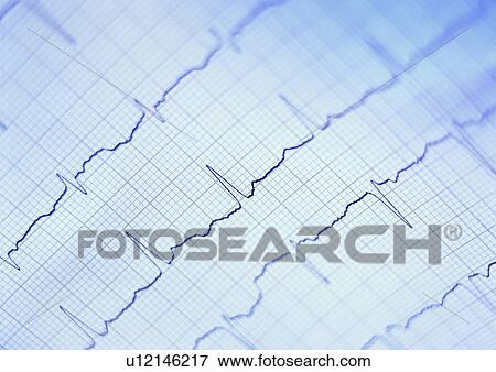 Sheet, Grid, Ecg, Graph, Close-Up, White, In The Bio Lab View Large Photo Image Stock Photo - Sheet, Grid, Ecg, Graph, Close-Up, White, In The Bio Lab. Fotosearch