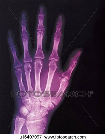 healthcare and medicine, film, treatment, case study, diagnostic medical tool, identification View Large Photo Image Stock Photo - healthcare and medicine, film, treatment, case study, diagnostic medical tool, identification. Fotosearch