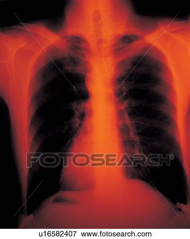 healthcare and medicine, identification, film, case study, science, x-ray View Large Photo Image Stock Photo - healthcare and medicine, identification, film, case study, science, x-ray. Fotosearch