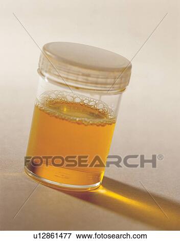 medical equipment, bottle, yellow View Large Photo Image Stock Photo - medical equipment, bottle, yellow. Fotosearch