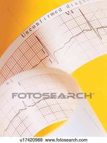 Stock Photo - medical equipment, healthcare and medicine, indoor. Fotosearch