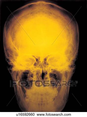 science, diagnosis, healthcare and medicine, indoor, case study, medical View Large Photo Image Stock Image - science, diagnosis, healthcare and medicine, indoor, case study, medical. Fotosearch