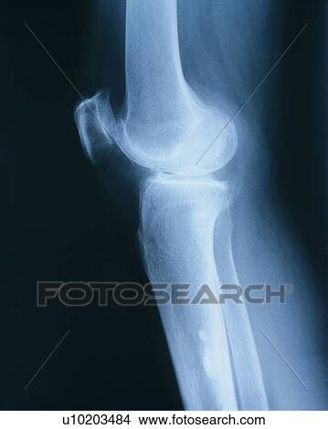 Black Background, Close-Up, Human Bone, Indoor View Large Photo Image Picture - Black Background, Close-Up, Human Bone, Indoor. Fotosearch