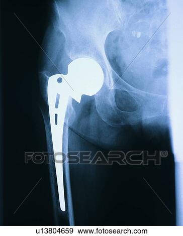Black Background, Close-Up, Human Bone, Indoor View Large Photo Image Stock Photo - Black Background, Close-Up, Human Bone, Indoor. Fotosearch