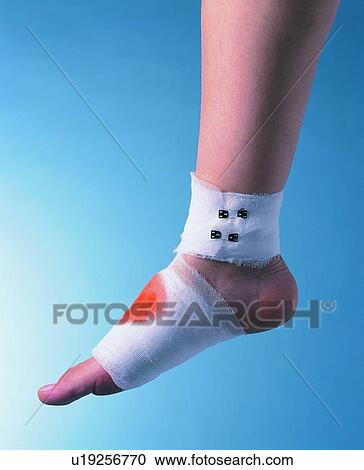 Healthcare And Medicine, Bandage, Stained, Human Leg, Close-Up View Large Photo Image Stock Image - Healthcare And Medicine, Bandage, Stained, Human Leg, Close-Up. Fotosearch