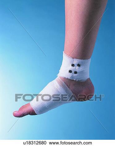 Stock Image - Indoor, Medical, Human Foot, Medicine, Science. Fotosearch