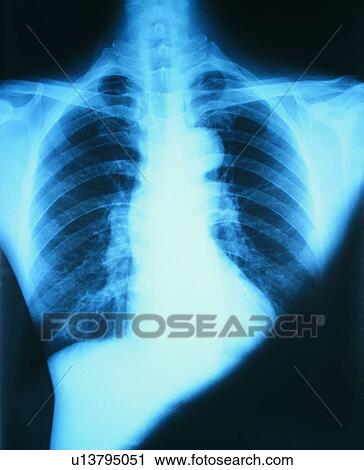 Part Of, Medical, Indoor, Medical Supplies, Healthcare And Medicine View Large Photo Image Stock Image - Part Of, Medical, Indoor, Medical Supplies, Healthcare And Medicine. Fotosearch