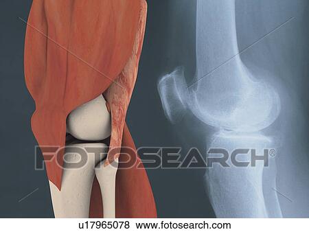 minute, atomic, science, magnified, healthcare View Large Photo Image Stock Photo - minute, atomic, science, magnified, healthcare. Fotosearch